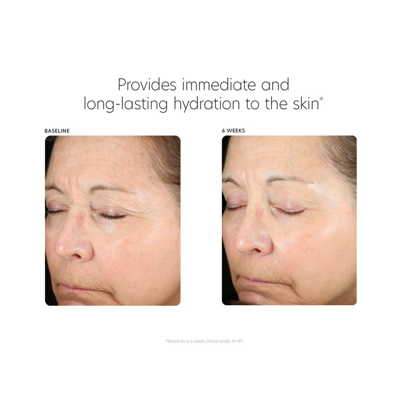PCA Skin Hyaluronic Acid Boosting Serum | Advanced Hydrating Face Serum 30ml